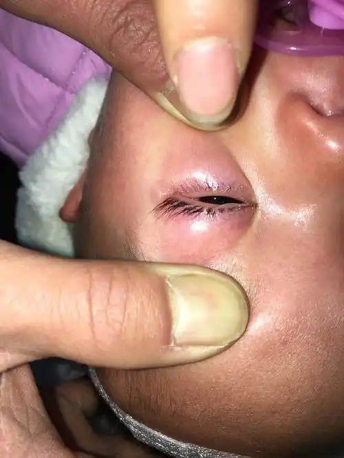 蛔虫是我们听闻最多的一种寄生虫,它的出现往往带着肠道,发育不良等