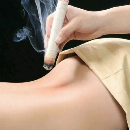 美容- 肾保 艾灸