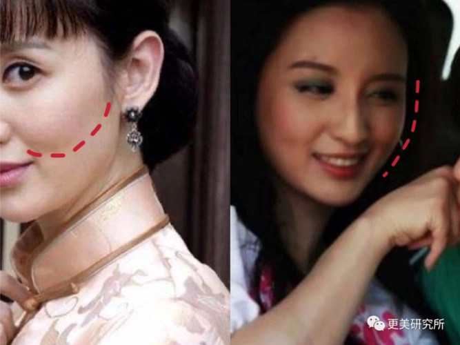 发现,张萌在不到30岁的时候,  眼窝,泪沟,面中都已经开始出现了凹陷