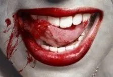 求带血的唇的图片