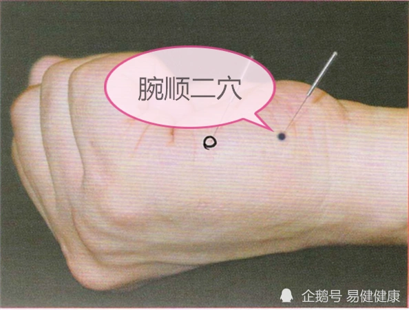 中医健康养生之人体手部穴位腕顺二穴