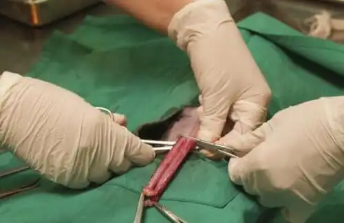 不过随着医疗技术水平越来越发达,现在男人也可以做结扎手术,当然夫妻