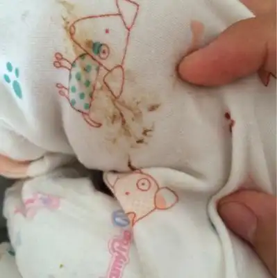 宝宝今天吐的奶好像有血,昨天哭的很厉害,不知道是不是嗓子哭伤了?