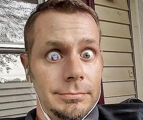 深沉的爱,美国球迷装上带拜仁队徽的义眼