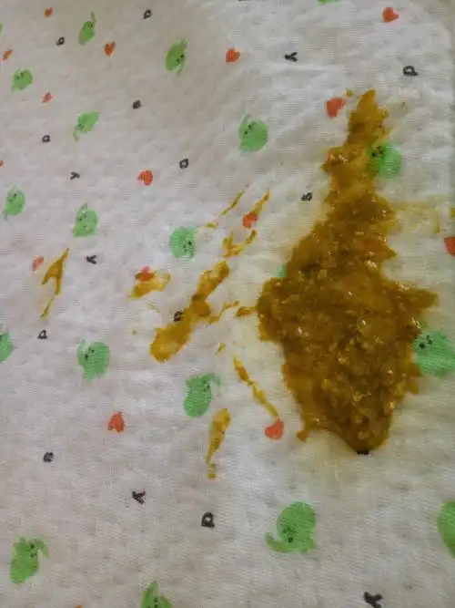 有经验的宝妈进来看看宝宝拉这样的屎正常吗