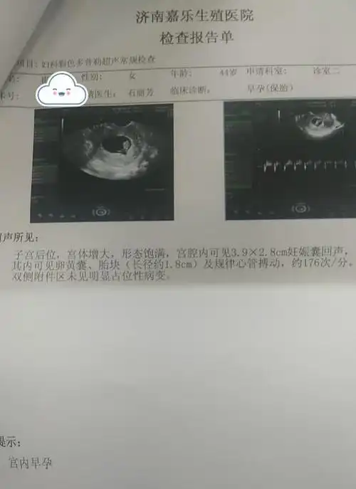 反复胎停难好孕,保胎石奶奶妙手助力高龄生育梦