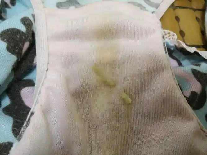 排卵同房2天后,流出黄色黏黏的浓稠白带,是啥分泌物.