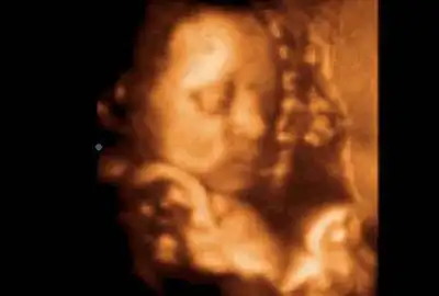 b超中的胎宝宝,千姿百态好可爱__网易亲子