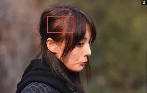 头顶上秃顶头发少了一片儿都不知道吗啊?网友直呼:工作太劳累吧!