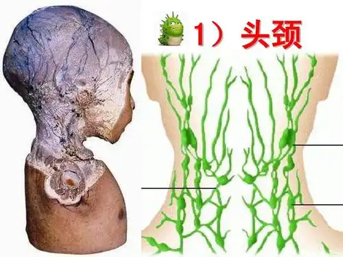 淋巴引流保健按摩ppt