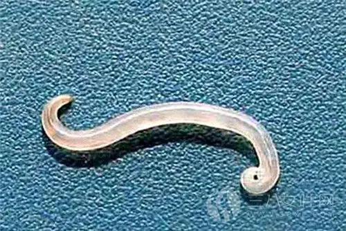 儿童常见肠道寄生虫病——蛲虫病