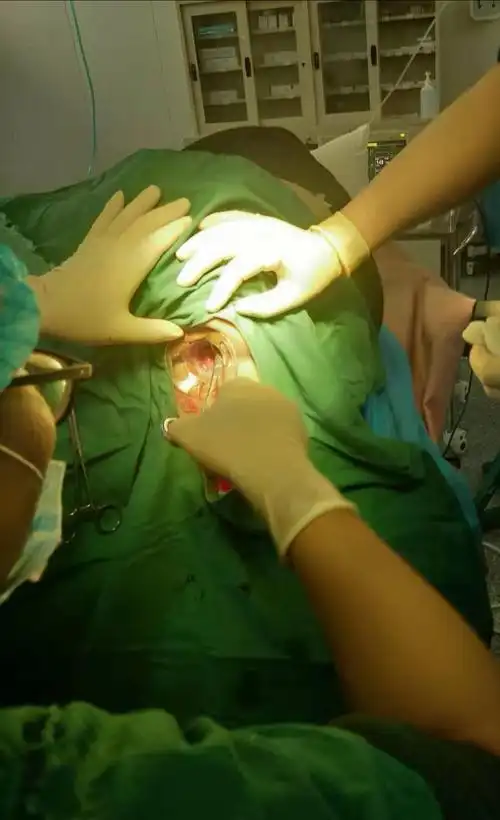 我院成功开展环状痔pph手术,让痔疮不再是"难言之隐"