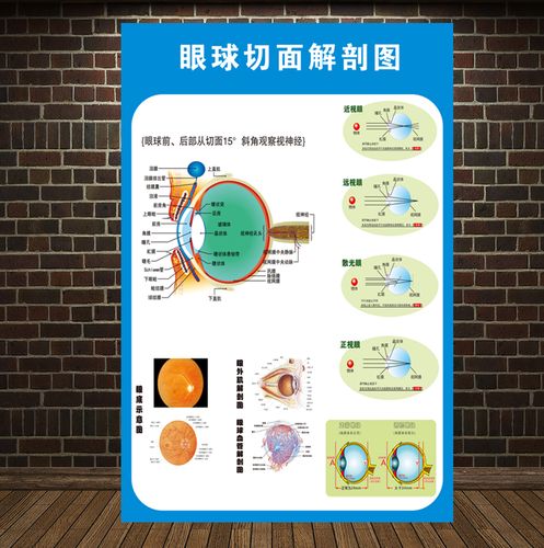 医院眼镜店展板宣传眼睛眼球剖面结构解剖图眼科广告海报挂画贴纸 06