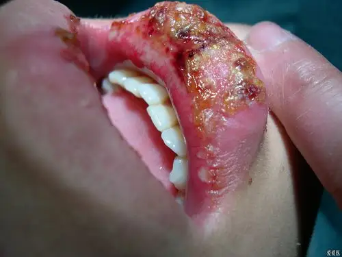 口腔医学专业讨论版 - 爱爱医医学论坛