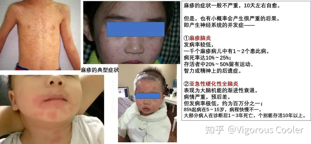 危机之时保持理智万不可因噎废食不打疫苗或只选进口