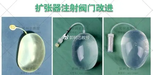 皮肤扩张技术四皮肤扩张器