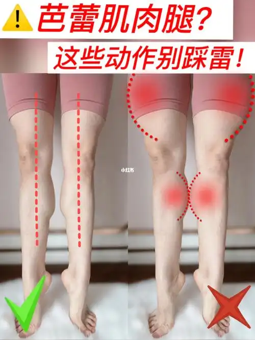 72芭蕾肌肉腿71这些粗腿动作你踩雷几个71