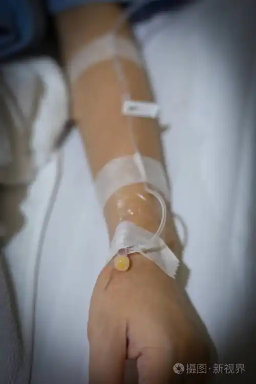 卧床病人静脉输液静脉注射