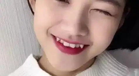 很像老虎口角的牙齿,所以就取了这么一个好听的名字——虎牙