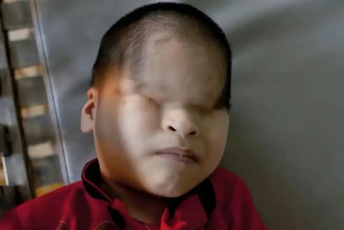 这些都是受到"橙剂"影响的畸形越南儿童,据统计,210万到480万不等的