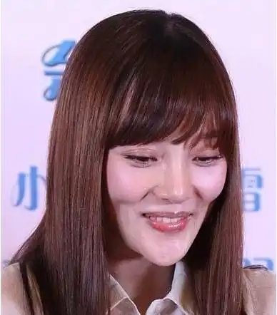 李小璐整容后遗症 鼻子变形_港台明星_大明星网