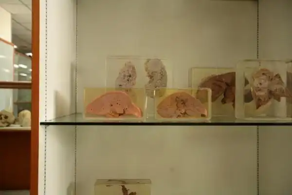 曼谷法医学博物馆真正的死亡博物馆