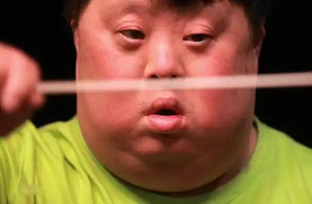 回顾智力障碍的舟舟19岁成天才指挥家父母生女儿给他养老送终