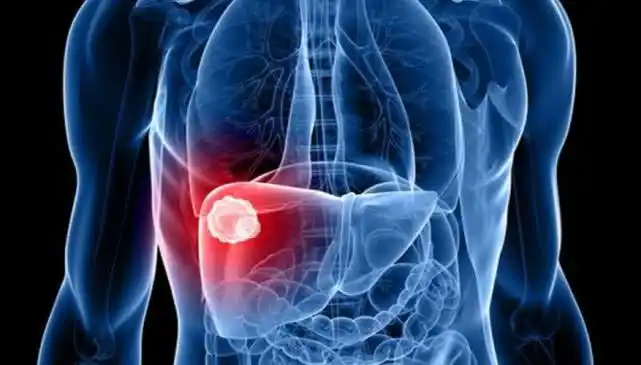 如果身体给出这7个"信号",其实是在暗示你肝不好了,早看早懂