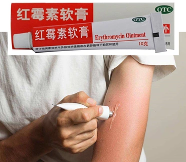 图1 生活中常见的皮肤外用软膏及使用状态