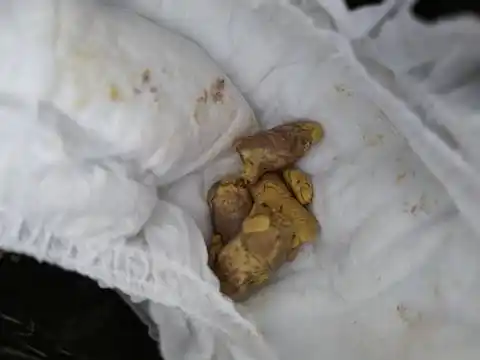 五个月宝宝大便干燥什么原因?