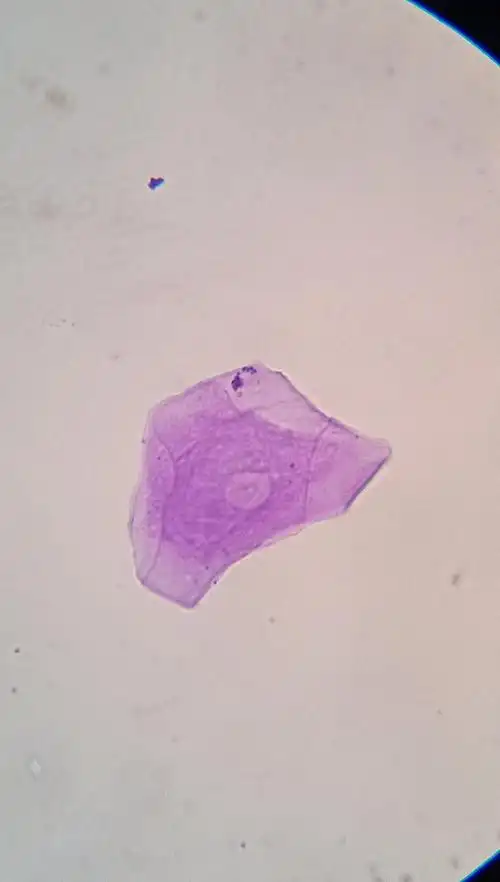 人的口腔上皮细胞(染色)