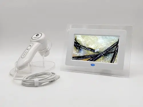 三光谱头皮检测仪 7寸屏毛发检测 皮肤检测 高清毛囊检测工厂直销