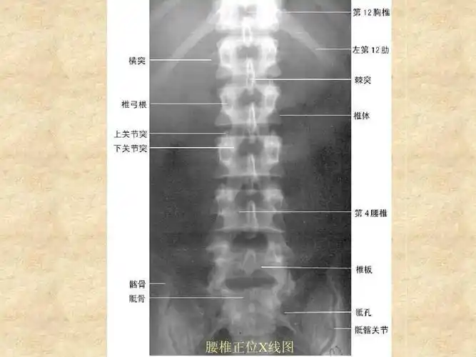 腰椎正位x线图