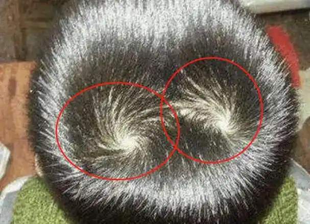 从头顶的旋能看出孩子性格和智力专家给出了结论对照一下