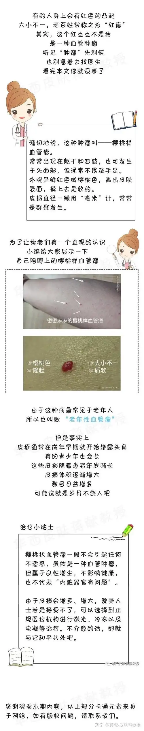 皮肤上的红痣樱桃样血管瘤