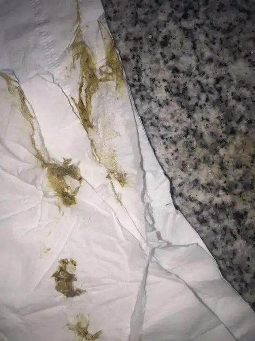 肝病患者.这个颜色算黑便么.