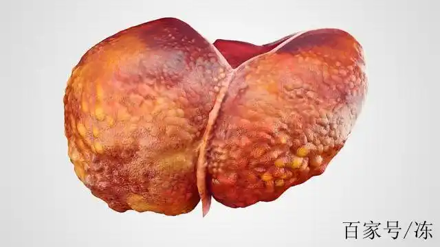 重度脂肪肝=肝损害大?医生:养肝蔬果这样吃,脂肪肝远离你!