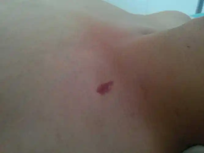 老公身上的,看着像吻痕,他在睡觉,我还没问.