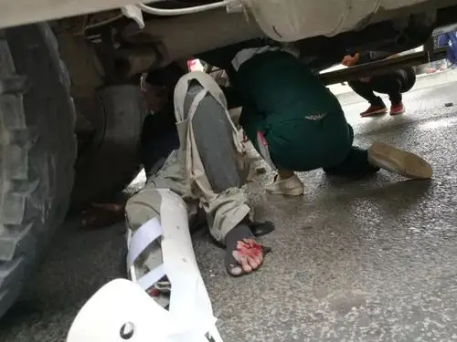 太原急救中心太钢站接到指令,丈子头高架桥下有一起车祸伤具体情况