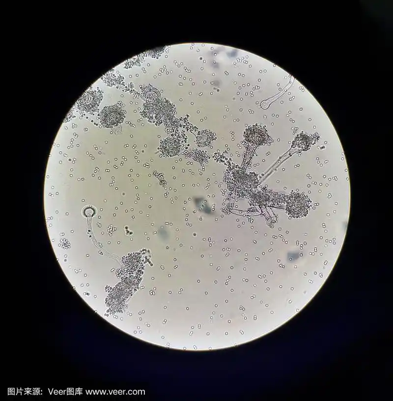 显微镜下的真菌曲霉.真菌微生物学