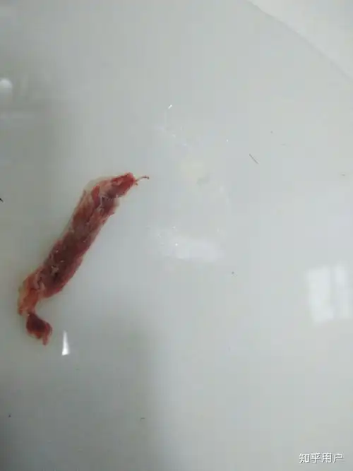 我也是 我换姨妈巾的时候看见有个好大的血块 以前都是直接丢,现在