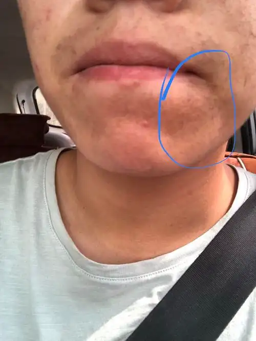 嘴下面半片黑点点,是什么啊?也不像是午子啊.有几年了.