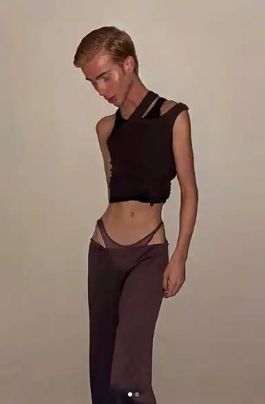 男星莫名暴瘦自称一切正常,网友们不淡定了:这瘦得诡异