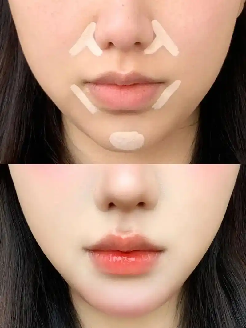 改善嘴凸鼻基底凹陷.真的有变嫩变温柔!视觉 - 抖音