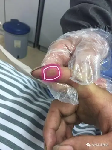 端午前夕,杭州小伙遇到一条银环蛇.