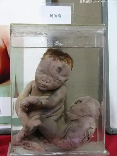 人体标本!云南博物馆