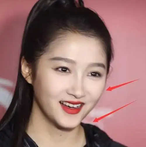 关晓彤化妆忘记涂脖子,无美颜下看见和脸的色差,少女感全无!