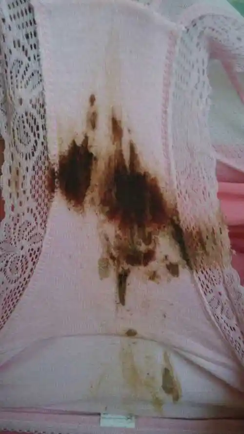 月经这个月没来原因有哪些 月经这个月没来是不是怀孕了