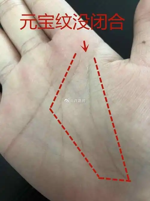 手相中的元宝纹,乃吉祥之兆,它巧妙交织着玉柱纹,智慧线与生命线等