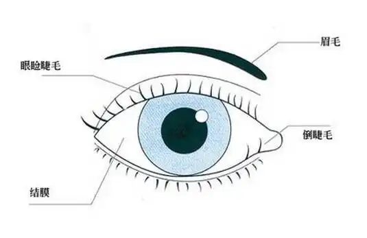 小孩总喜欢揉眼睛小心可能长了倒睫毛